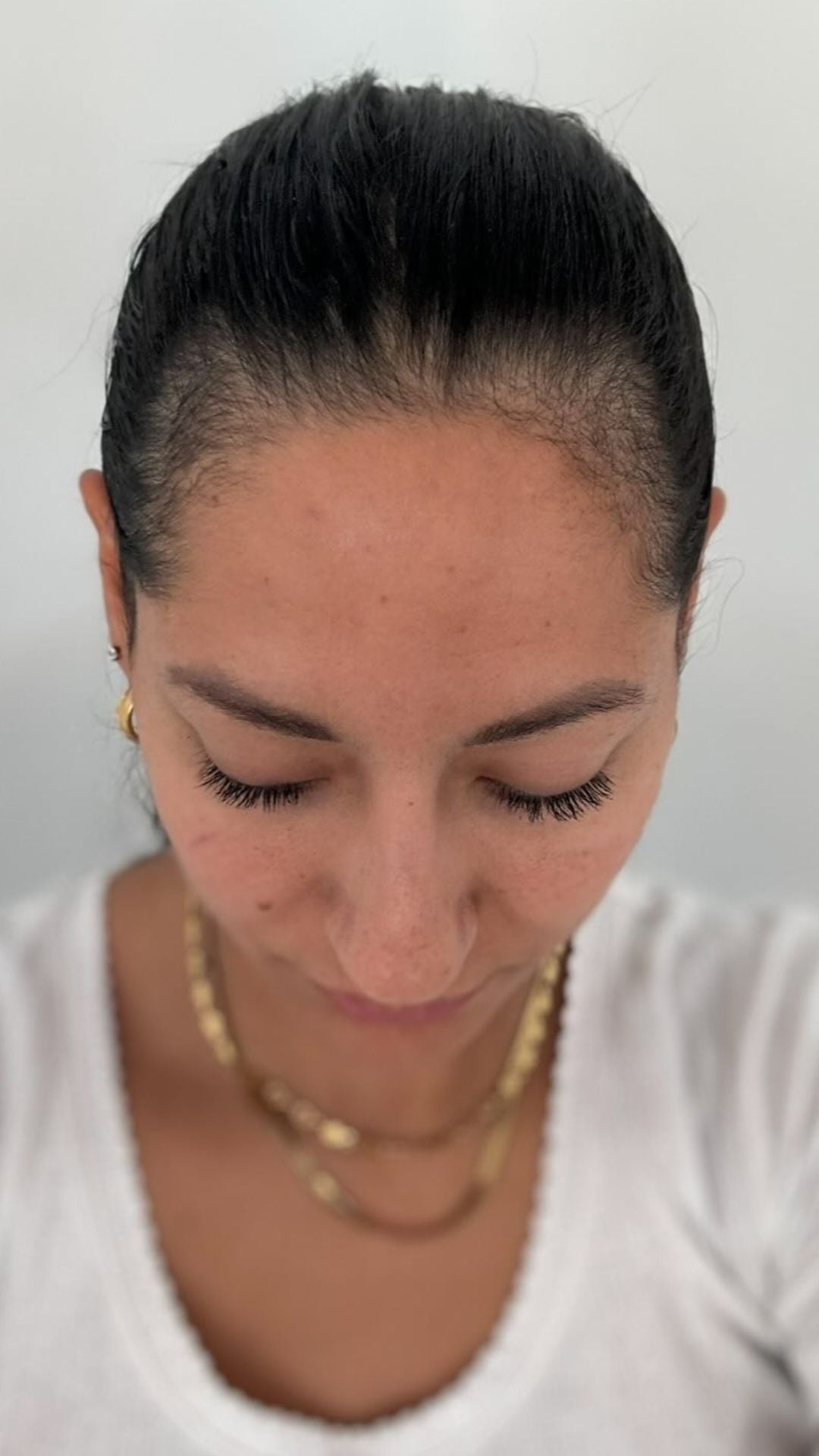 Before - Frida F.