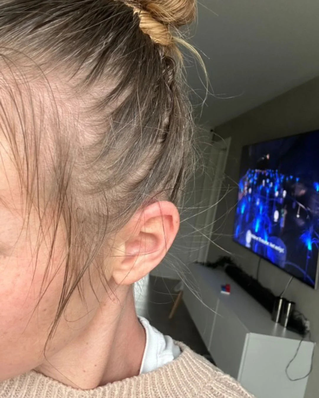 Before - Camilla S.