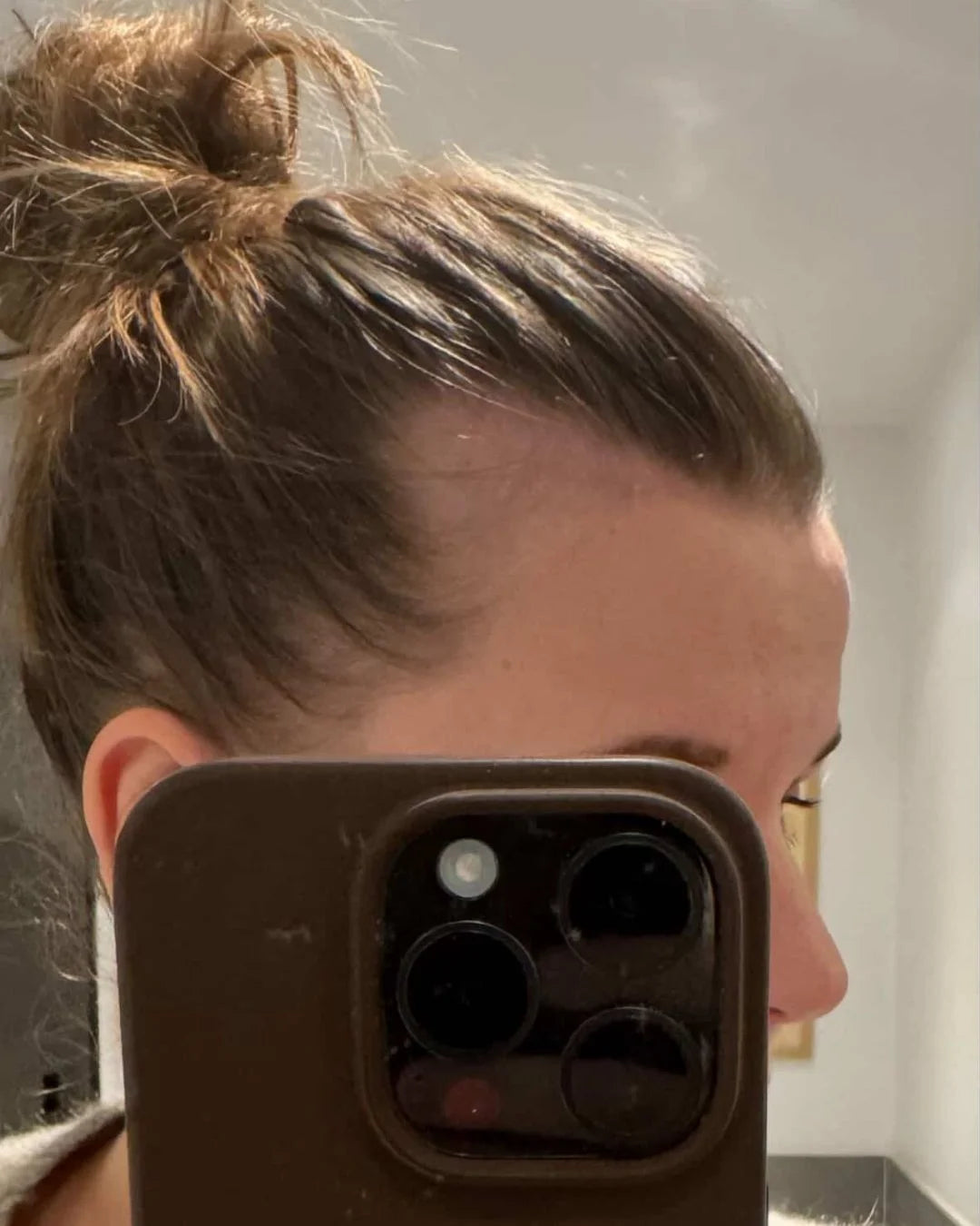 Before - Cecilie Dyrhave